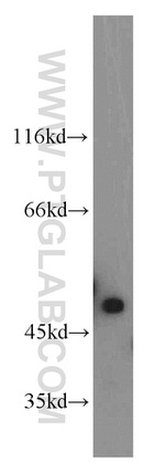 NSFL1C Antibody in Western Blot (WB)