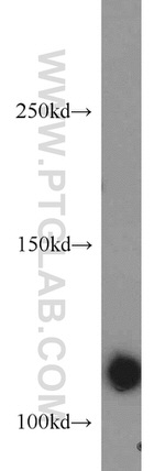 RNF40 Antibody in Western Blot (WB)