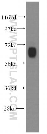 GABRD Antibody in Western Blot (WB)