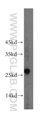 EXOSC5 Antibody in Western Blot (WB)
