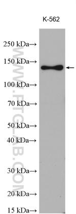 NRD1 Antibody in Western Blot (WB)