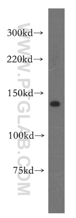 NRD1 Antibody in Western Blot (WB)