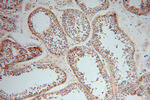 NRD1 Antibody in Immunohistochemistry (Paraffin) (IHC (P))
