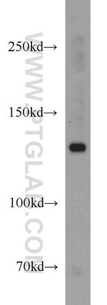 NRD1 Antibody in Western Blot (WB)