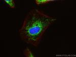 HSDL2 Antibody in Immunocytochemistry (ICC/IF)