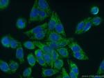 HSDL2 Antibody in Immunocytochemistry (ICC/IF)
