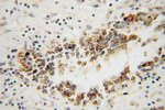 HSDL2 Antibody in Immunohistochemistry (Paraffin) (IHC (P))