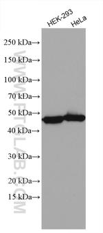 HSDL2 Antibody in Western Blot (WB)