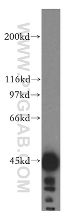 HSDL2 Antibody in Western Blot (WB)