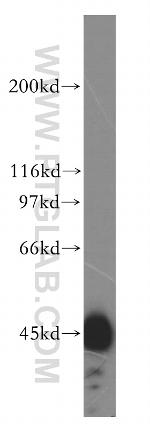 HSDL2 Antibody in Western Blot (WB)