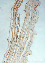 ACOT2 Antibody in Immunohistochemistry (Paraffin) (IHC (P))