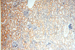 ACOT2 Antibody in Immunohistochemistry (Paraffin) (IHC (P))