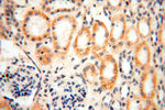 ACOT2 Antibody in Immunohistochemistry (Paraffin) (IHC (P))