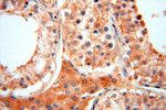 ACOT2 Antibody in Immunohistochemistry (Paraffin) (IHC (P))