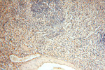 ACOT2 Antibody in Immunohistochemistry (Paraffin) (IHC (P))