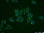 ADPGK Antibody in Immunocytochemistry (ICC/IF)