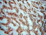ADPGK Antibody in Immunohistochemistry (Paraffin) (IHC (P))