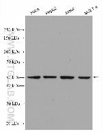 ADPGK Antibody in Western Blot (WB)
