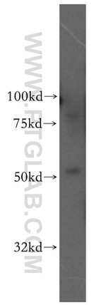 ADPGK Antibody in Western Blot (WB)