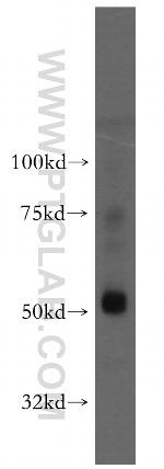ADPGK Antibody in Western Blot (WB)