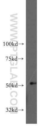 ADPGK Antibody in Western Blot (WB)