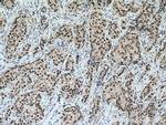 POLD1 Antibody in Immunohistochemistry (Paraffin) (IHC (P))