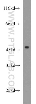 IL17RC Antibody in Western Blot (WB)