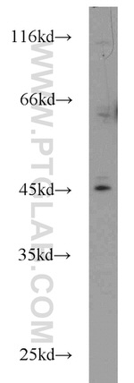 IL17RC Antibody in Western Blot (WB)