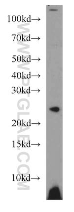GINS3 Antibody in Western Blot (WB)