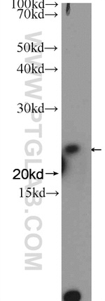 GINS3 Antibody in Western Blot (WB)