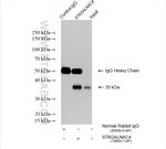 ST6GALNAC4 Antibody in Immunoprecipitation (IP)