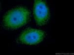 PIWIL1 Antibody in Immunocytochemistry (ICC/IF)