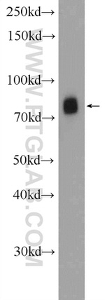 PIWIL1 Antibody in Western Blot (WB)