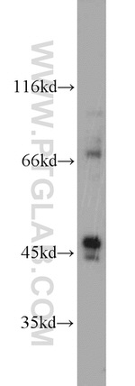 CADM3 Antibody in Western Blot (WB)