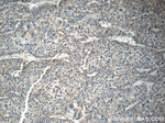 RAB14 Antibody in Immunohistochemistry (Paraffin) (IHC (P))