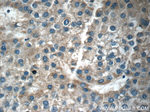 RAB14 Antibody in Immunohistochemistry (Paraffin) (IHC (P))