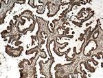 RAB14 Antibody in Immunohistochemistry (Paraffin) (IHC (P))