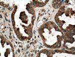 RAB14 Antibody in Immunohistochemistry (Paraffin) (IHC (P))
