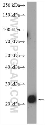 RAB14 Antibody in Western Blot (WB)