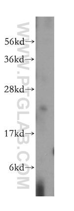 RAB14 Antibody in Western Blot (WB)