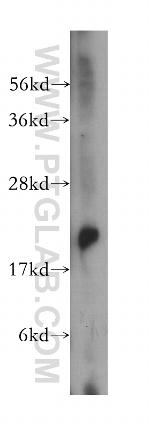 RAB14 Antibody in Western Blot (WB)