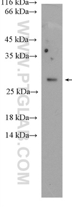 RAB14 Antibody in Western Blot (WB)