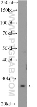 NRIP3 Antibody in Western Blot (WB)