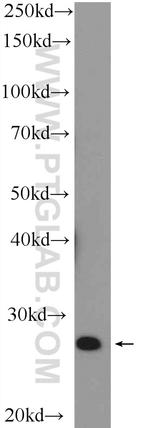NRIP3 Antibody in Western Blot (WB)