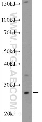 NRIP3 Antibody in Western Blot (WB)