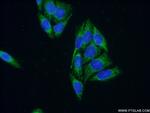 ARHGAP9 Antibody in Immunocytochemistry (ICC/IF)
