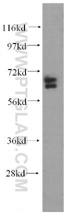 ARHGAP9 Antibody in Western Blot (WB)