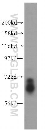 ARHGAP9 Antibody in Western Blot (WB)