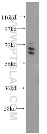 ARHGAP9 Antibody in Western Blot (WB)