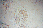 VPS25 Antibody in Immunohistochemistry (Paraffin) (IHC (P))